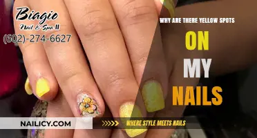 Yellow Spots on Nails: Causes, Concerns, and Solutions Explained