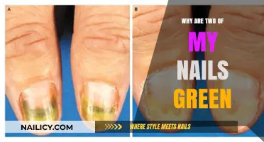 Green Nails Mystery: Causes and Solutions for Unusual Nail Color