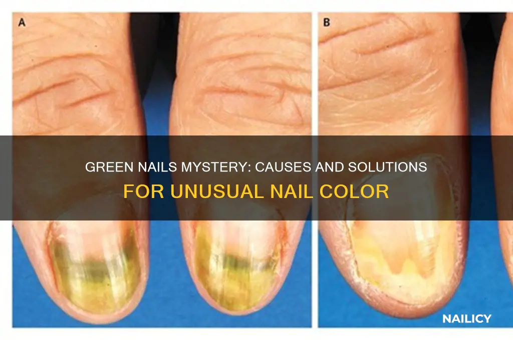 why are two of my nails green