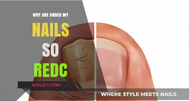 Why Are My Nails So Red? Causes and Solutions Explained