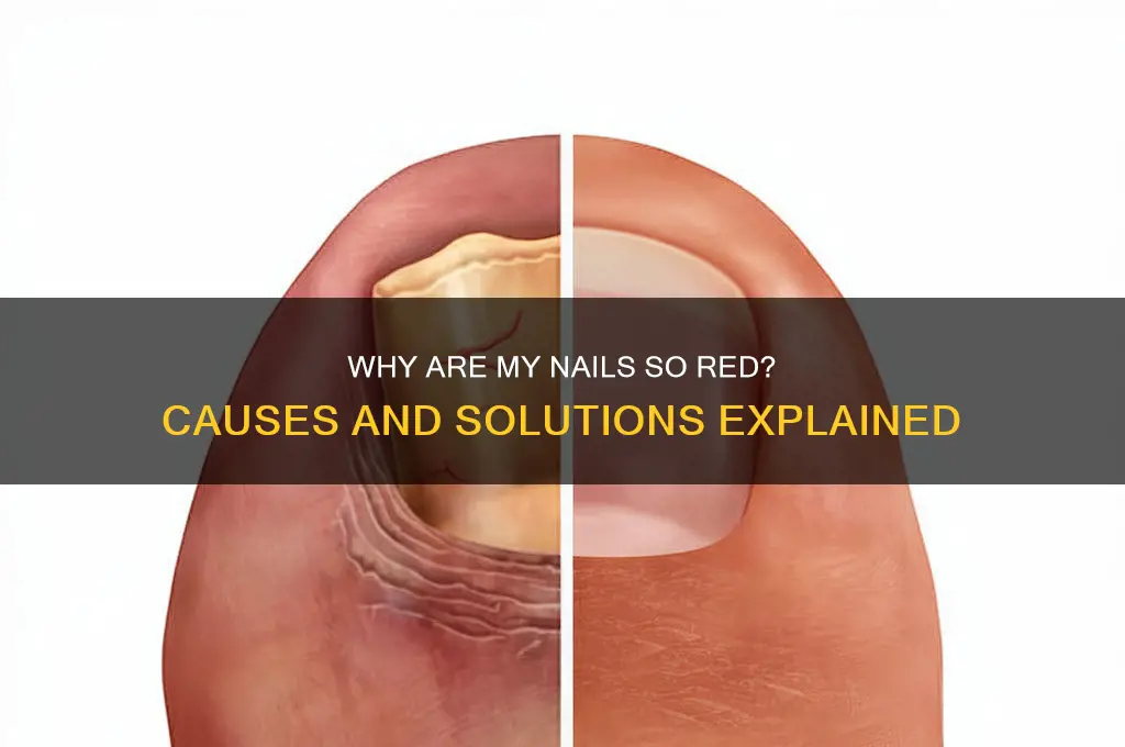 why are under my nails so redc