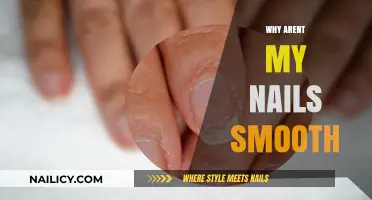 Why Aren't My Nails Smooth? Causes and Solutions for Rough Nails