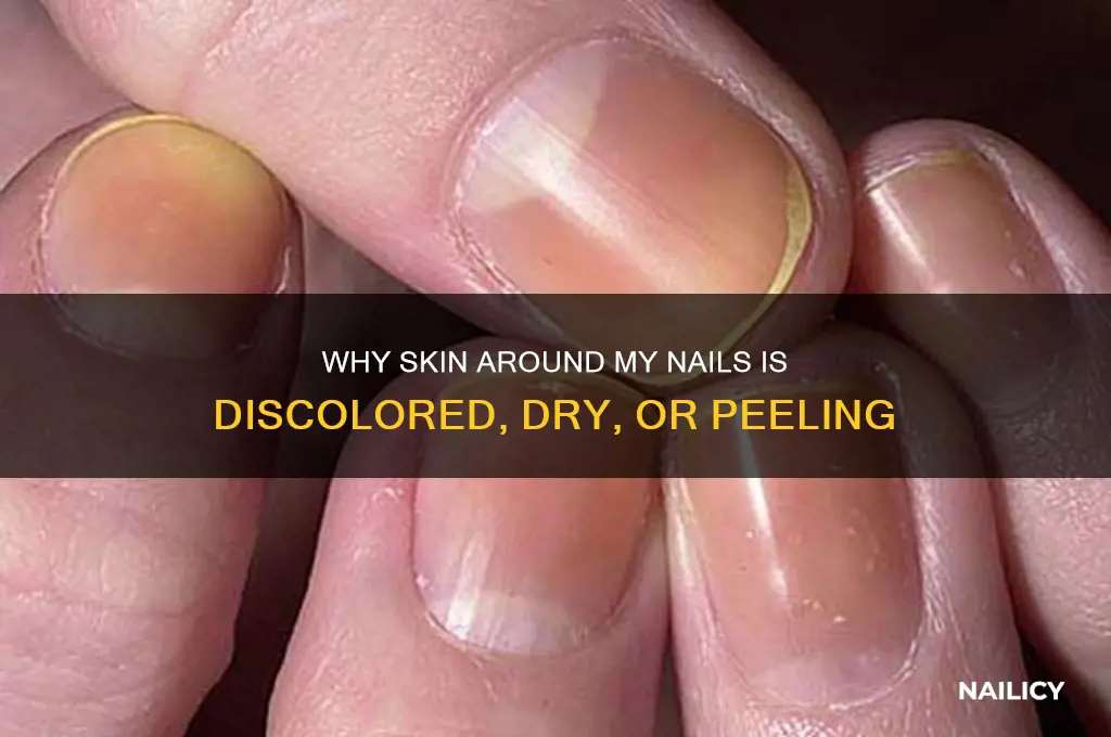 why around my nails