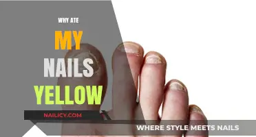 Why Are My Nails Yellow? Causes and Solutions Explained