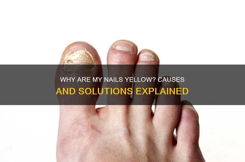 why ate my nails yellow