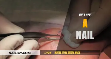 Understanding Nail Biopsies: Reasons, Procedure, and Diagnostic Benefits