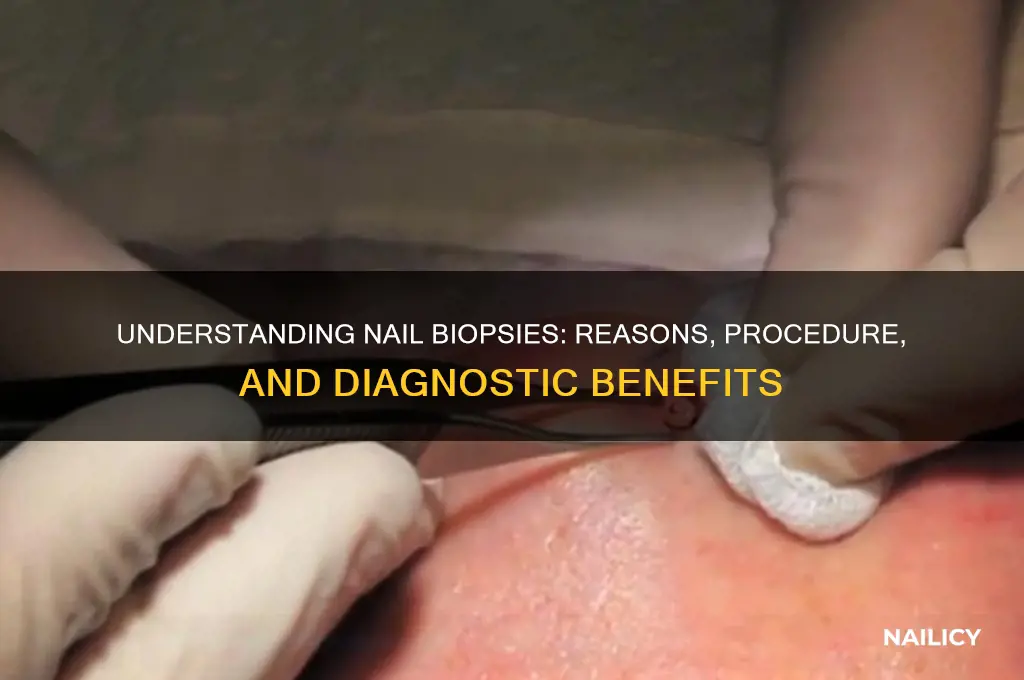 why biopsy a nail