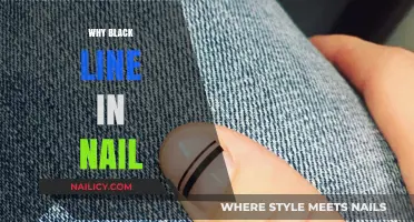 Understanding the Black Line in Your Nail: Causes and Concerns