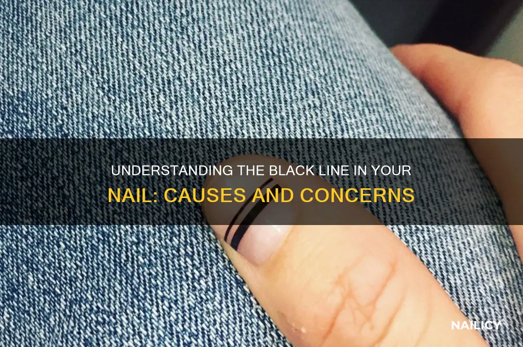 why black line in nail