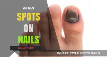 Understanding Black Spots on Nails: Causes, Concerns, and Solutions