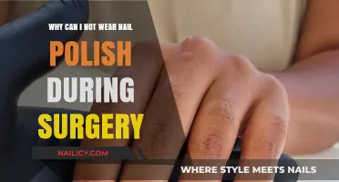 Surgical Safety: Why Nail Polish is Prohibited in the Operating Room