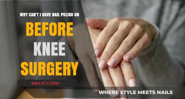 Nail Polish and Knee Surgery: Why It’s a Pre-Op No-Go