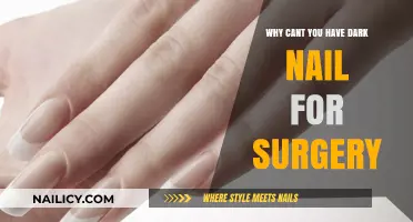 Why Dark Nail Polish is Prohibited Before Surgery: Safety Explained