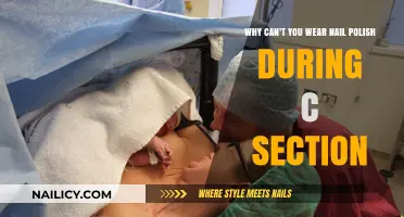 Nail Polish and C-Sections: Why It’s a No-Go During Surgery