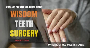 Nail Polish and Wisdom Teeth Surgery: Why It’s a No-Go
