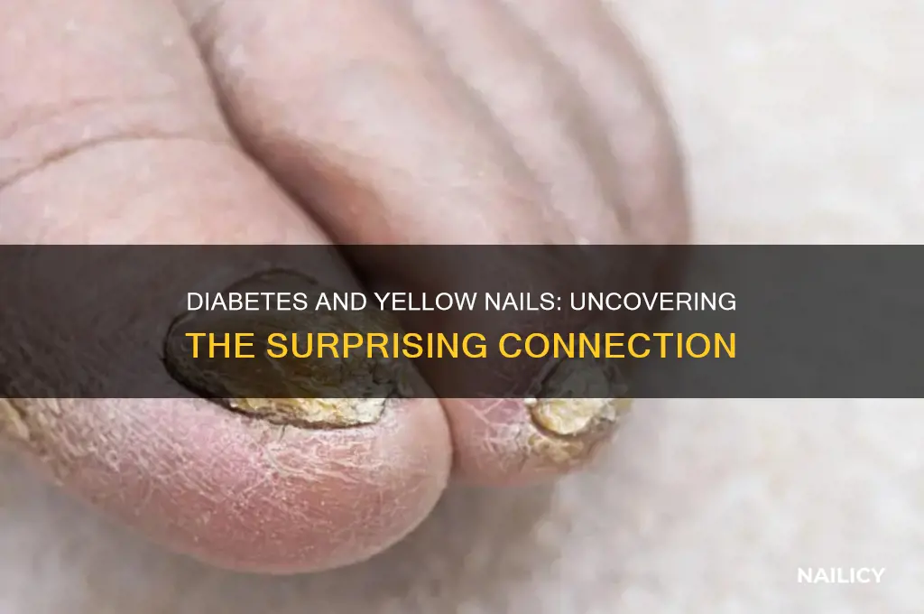 why diabetes have yellow nails