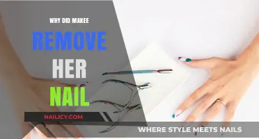 Makee's Nail Removal: Why She Did It