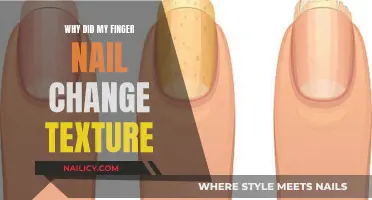 Unraveling the Mystery: Why Did My Finger Nail Texture Change?