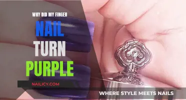 Purple Fingernail: What Does It Mean?