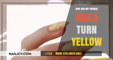 Why French Nails Turn Yellow: Causes and Prevention Tips