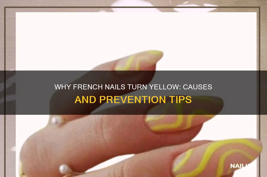 why did my french nails turn yellow