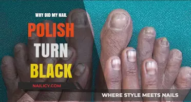 Why Did My Nail Polish Turn Black? Causes and Solutions
