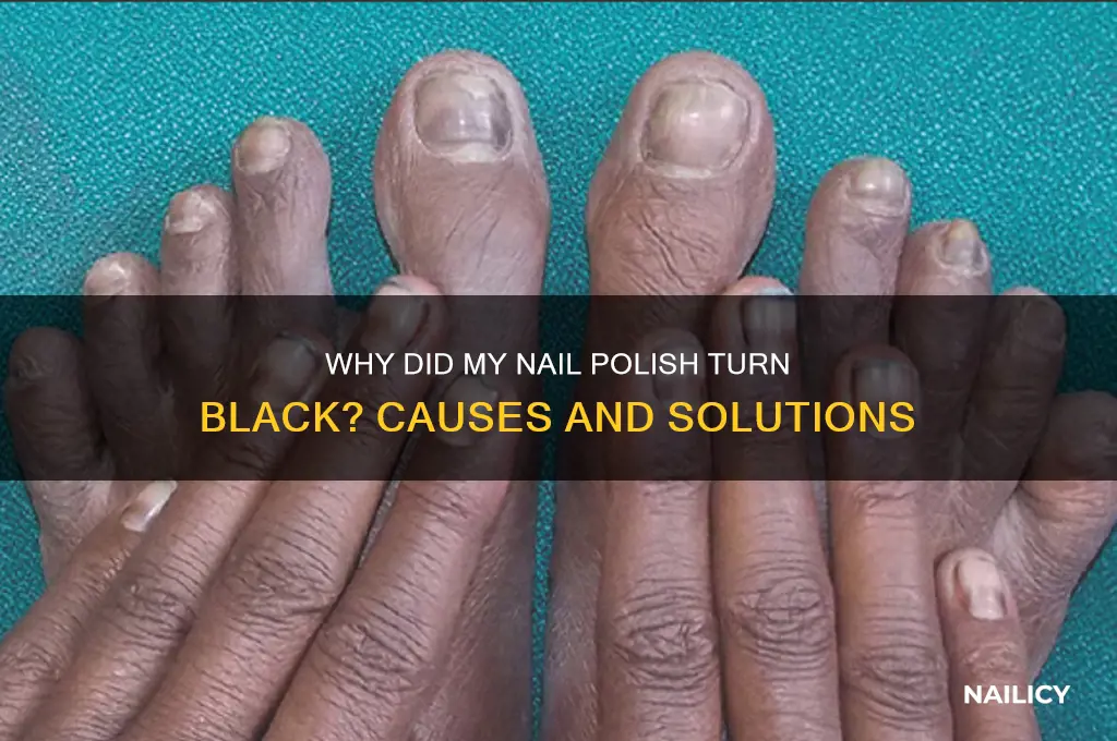 why did my nail polish turn black