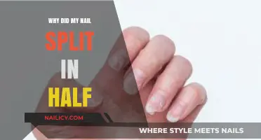 Why Did My Nail Split in Half? Causes and Solutions