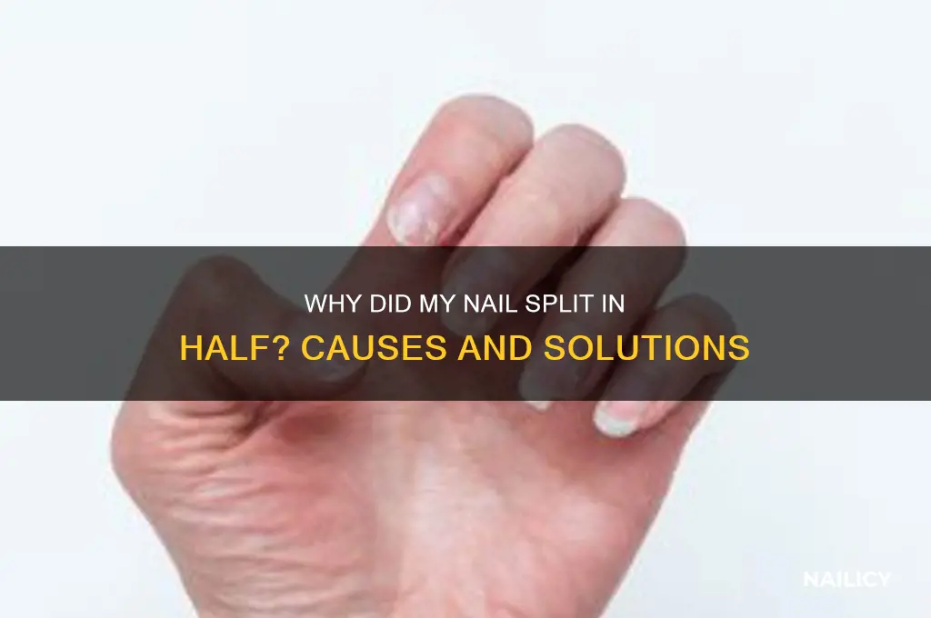why did my nail split in half