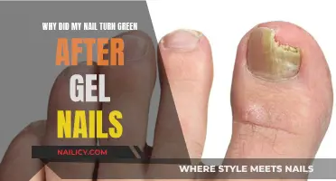 Gel Nails Gone Wrong: Green Nails, What's the Deal?