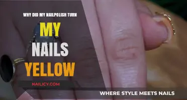 Why Nail Polish Turns Nails Yellow: Causes and Prevention Tips