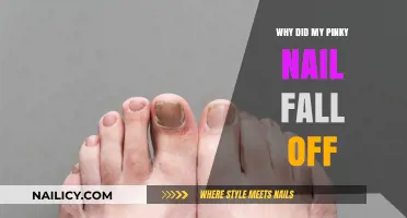 Why Did My Pinky Nail Fall Off? Causes and Solutions