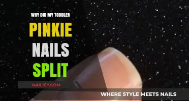 Why Toddler Pinkie Nails Split: Causes and Gentle Care Tips