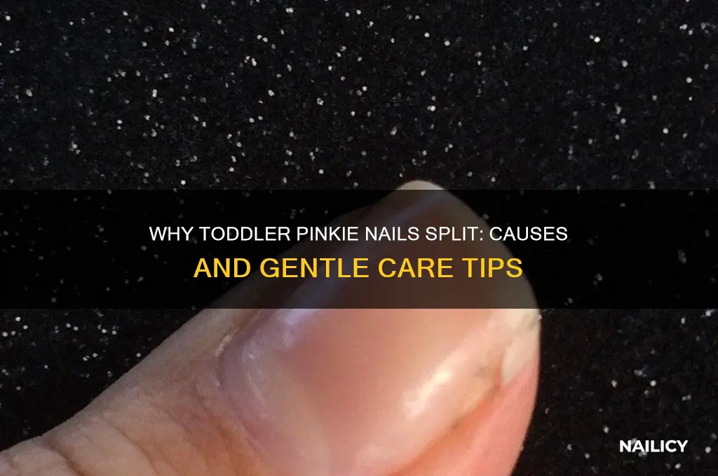 why did my toddler pinkie nails split