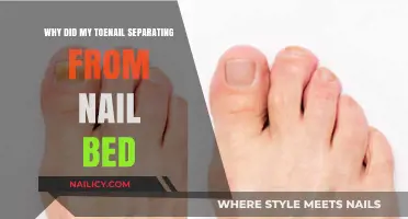 Toenail Separating from Nail Bed: Causes and Solutions Explained