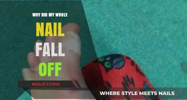 Why Did My Whole Nail Fall Off? Causes and Solutions Explained
