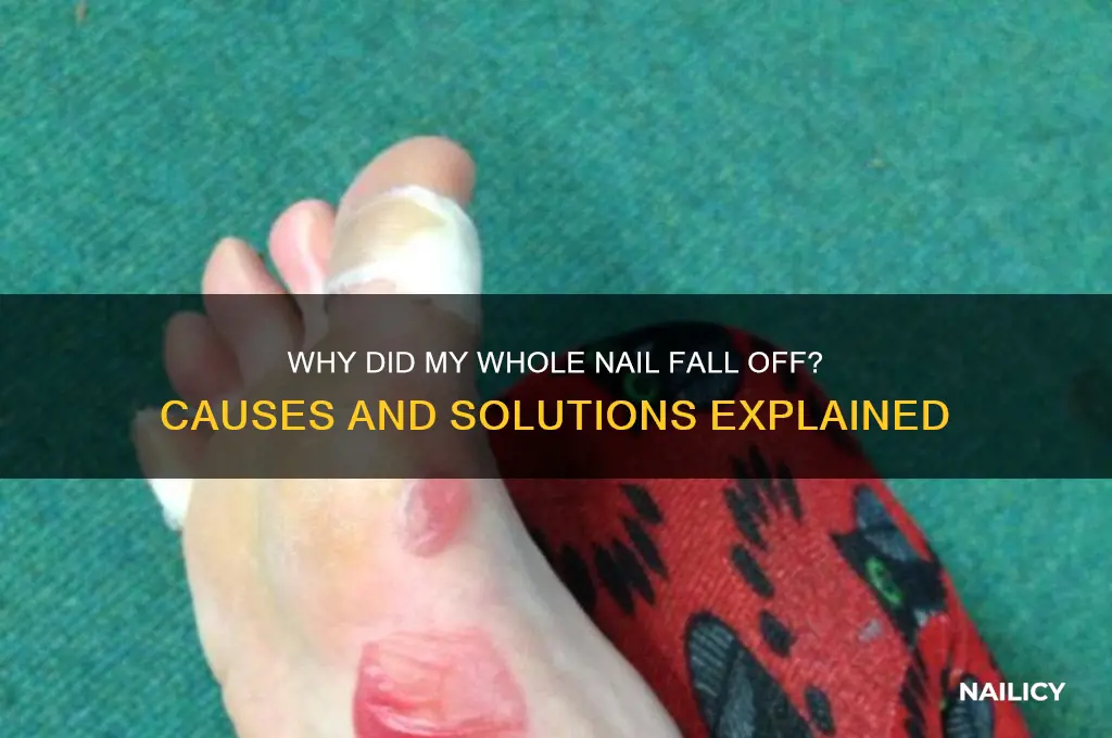why did my whole nail fall off