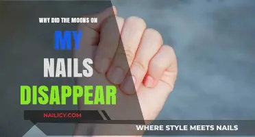 Why Do Nail Moons Disappear? Understanding the Causes and Solutions