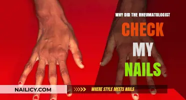 Why Rheumatologists Examine Your Nails: Uncovering Hidden Clues to Joint Health