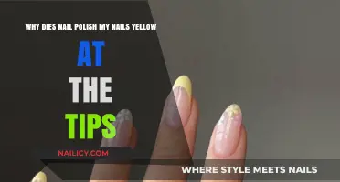 Why Does Nail Polish Turn My Nails Yellow at the Tips?