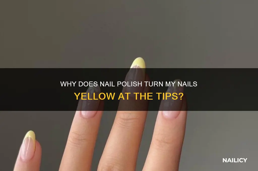 why dies nail polish my nails yellow at the tips