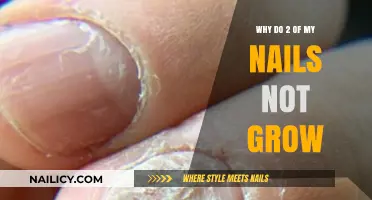 Nail Growth: Why Are Two Nails Not Growing?