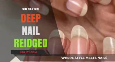 Deep Nail Ridges Explained: Causes and Solutions for Healthy Nails