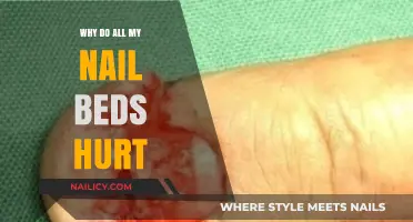 Why Do All My Nail Beds Hurt? Causes and Remedies Explained