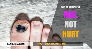 Why Bruises Near Nails Are Pain-Free: Uncovering the Science