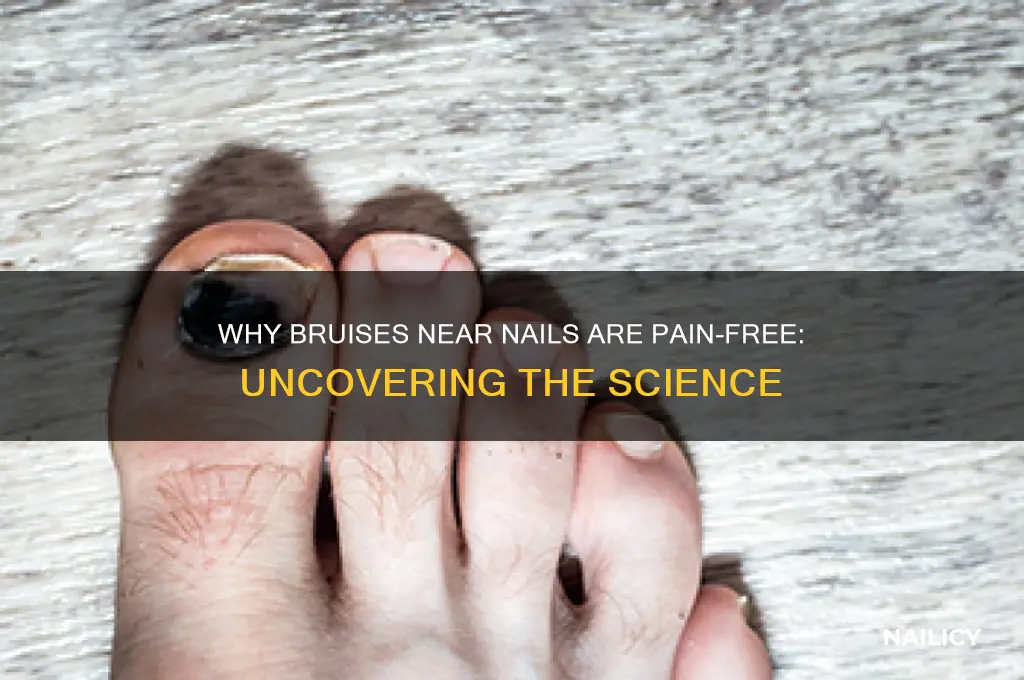 why do bruise near nail not hurt