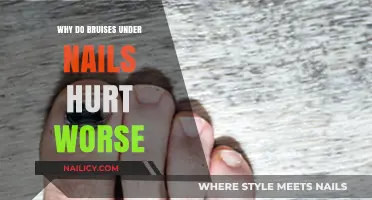 Why Bruises Under Nails Cause Intense Pain: Uncovering the Science