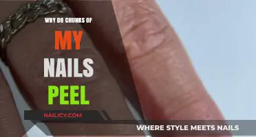Why Do Chunks of My Nails Peel? Causes and Solutions