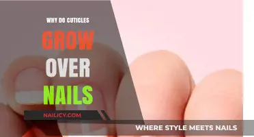 Cuticles: Why They Grow Over Nails