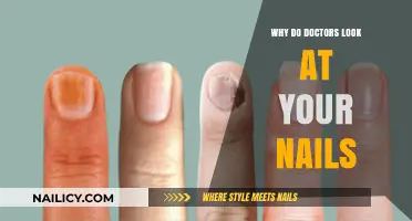 Why Doctors Examine Your Nails: Uncovering Hidden Health Clues